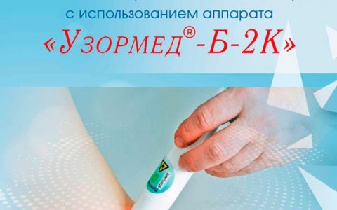 Надвенное лазерное облучение крови с использованием аппарата лазерной терапии «УзорМед-Б-2К-НЛОК»